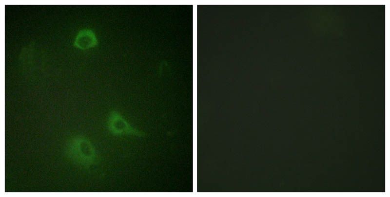 NMDAR1 (Phospho-Ser890) Rabbit Polyclonal Antibody, 100 ug