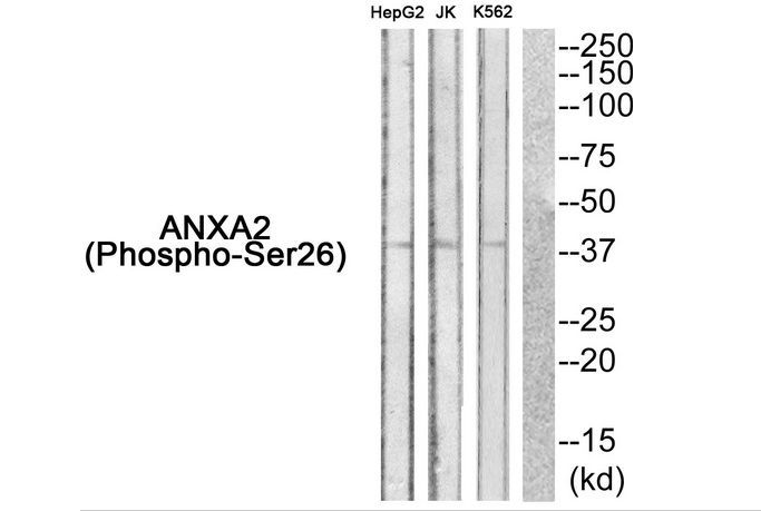 ANXA2 (Phospho-Ser26) Rabbit Polyclonal Antibody, 100 ug