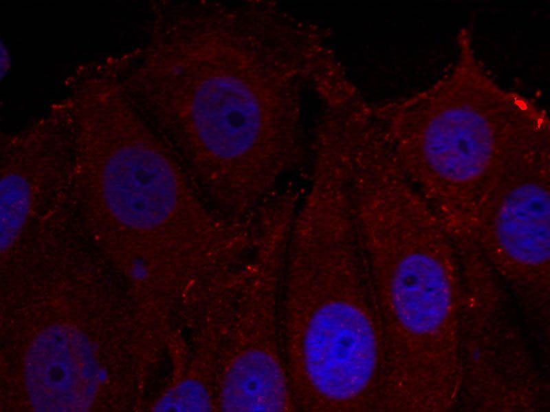 α-Synuclein (Phospho-Tyr133) Rabbit Polyclonal Antibody, 100 ug