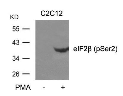 eIF2β (phospho-Ser2) Rabbit Polyclonal Antibody, 100 ug