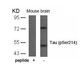 Tau (Phospho-Ser214) Rabbit Polyclonal Antibody, 100 ug