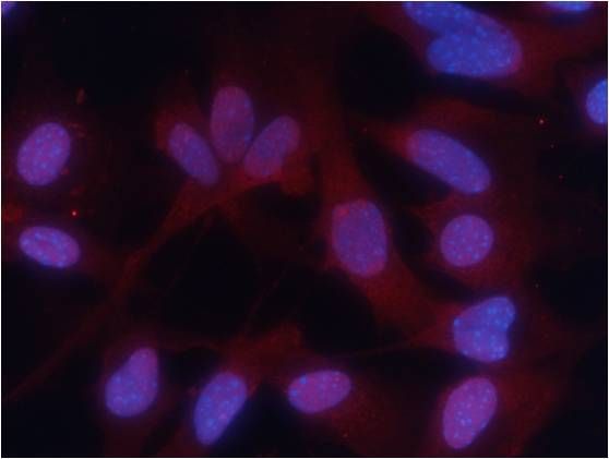 PKM2(phospho-Ser37) Rabbit Polyclonal Antibody, 100 ug