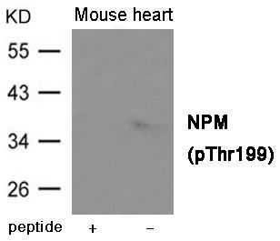 NPM (Phospho-Thr199) Rabbit Polyclonal Antibody, 100 ug