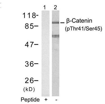 β-Catenin (Phospho-Thr41/Ser45) Rabbit Polyclonal Antibody, 100 ug