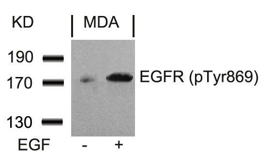 EGFR (Phospho-Tyr869) Rabbit Polyclonal Antibody, 100 ug