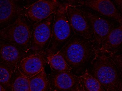 IGF-1R (Phospho-Tyr1165/Tyr1166) Rabbit Polyclonal Antibody, 100 ug IGF-1R (Phospho-Tyr1165/Tyr1166) Rabbit Polyclonal Antibody, 100 ug