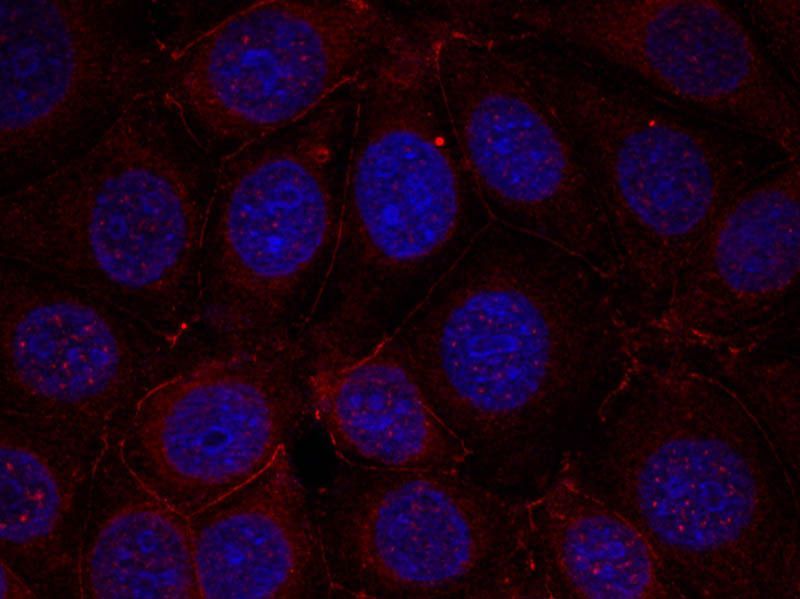 IGF-1R (Phospho-Tyr1165/Tyr1166) Rabbit Polyclonal Antibody, 100 ug