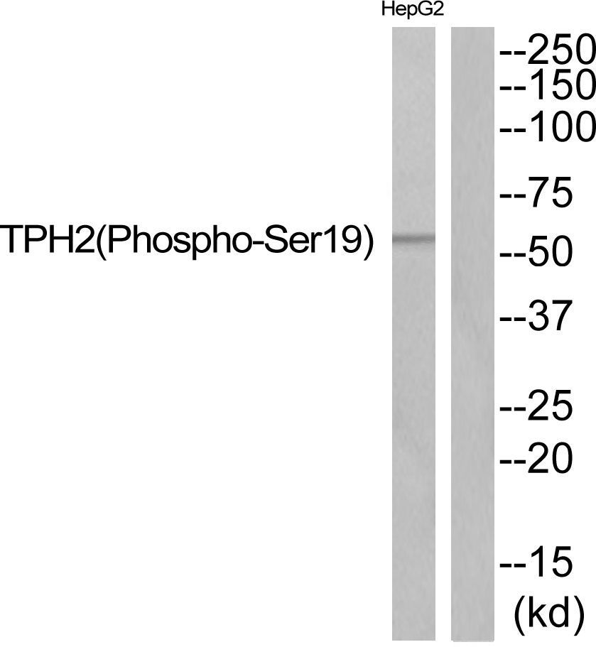 TPH2 (Phospho-Ser19) Rabbit Polyclonal Antibody, 100 ug
