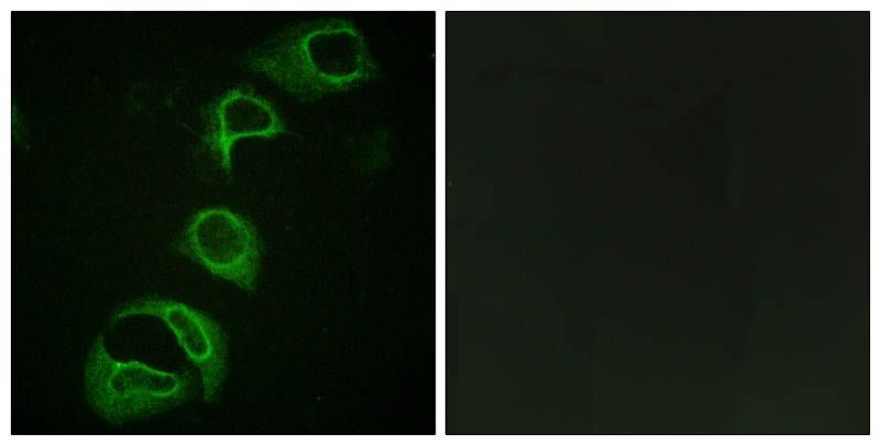 ALK (Phospho-Tyr1604) Rabbit Polyclonal Antibody, 100 ug