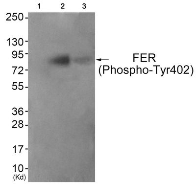 FER (Phospho-Tyr402) Rabbit Polyclonal Antibody, 100 ug