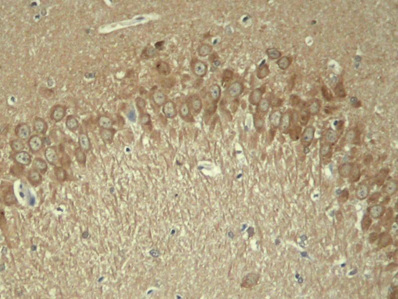 Tau (Phospho-Thr181) Rabbit Polyclonal Antibody, 100 ug