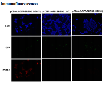 Anti ERBB2(D769Y) Mouse Monoclonal Antibody, 100 ul (26382)