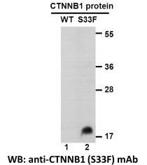 Anti CTNNB1(S33F) Mouse Monoclonal Antibody, 100 ul (26304), NEBA10275 Anti CTNNB1(S33F) Mouse Monoclonal Antibody, 100 ul (26304), NEBA10275