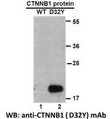 Anti CTNNB1(D32Y) Mouse Monoclonal Antibody, 100 ul (26302)