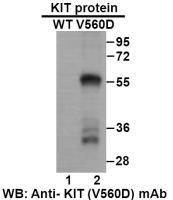 Anti KIT(V560D) Mouse Monoclonal Antibody, 100 ul (26281)