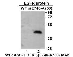 Anti EGFR(E746-A750)del Mouse Monoclonal Antibody, 100 ul (26235)