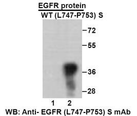 Anti-EGFR (L747-P753) S Mouse Monoclonal Antibody, 100 ul (26287)