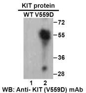 Anti KIT(V559D) Mouse Monoclonal Antibody, 100 ul (26277), NEBA10263 Anti KIT(V559D) Mouse Monoclonal Antibody, 100 ul (26277), NEBA10263