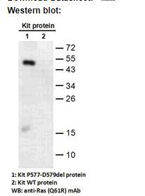 Anti KIT (P577-D579 DEL) Mouse Monoclonal Antibody, 100 ul (26288)
