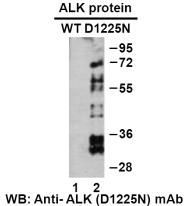Anti ALK(D1225N) Mouse Monoclonal Antibody, 100 ul (26290)