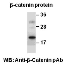 Anti-β-catenin Rabbit Polyclonal Antibody, 100 µl (21282), NEBA10095