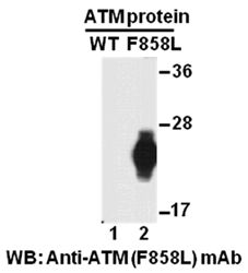 Anti-ATM (F858L) Mouse Monoclonal Antibody, 100 µl (26141), NEBA10173