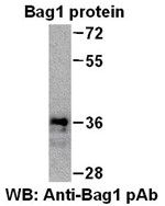 Anti-Bag1 Rabbit Polyclonal Antibody, internal immunogen, 100 µl (21231), NEBA10083