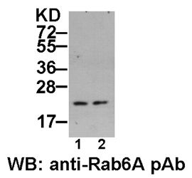 Anti-Rab6A Rabbit Polyclonal Antibody, 100 µl (21068), NEBA10042