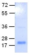 CST3 Protein, 100 µg, (10157) NEBCC0067
