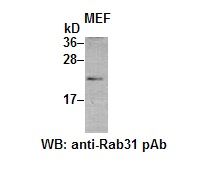 Anti-Rab31 Rabbit Polyclonal Antibody, 100 µl (21063), NEBA10041