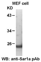 Anti-Sar1a Rabbit Polyclonal Antibody, 100 µl (21090), NEBA10052