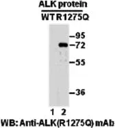 Anti-ALK (R1275Q) Mouse Monoclonal Antibody, 100 µl (26151), NEBA10176