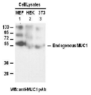 Anti-MUC1 Rabbit Polyclonal Antibody, 100 µl (21123), NEBA10061