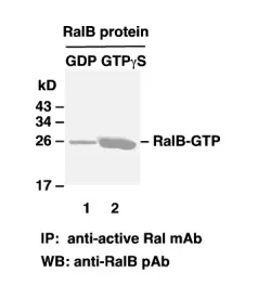 RalB Activation Assay Kit, 30 Assays (81501) NEBB40021