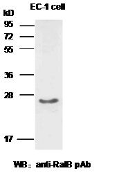 Anti-RalB Rabbit Polyclonal Antibody, 100 µl (21033), NEBA10021