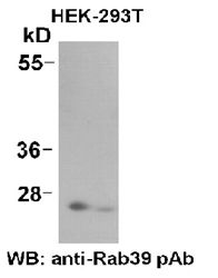 Anti-Rab39 Rabbit Polyclonal Antibody, 100 µl (21082), NEBA10049 Anti-Rab39 Rabbit Polyclonal Antibody, 100 µl (21082), NEBA10049