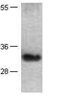 Anti-TFF3 Mouse Monoclonal Antibody, 100 µl (26047), NEBA10129
