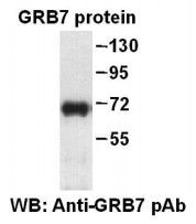 Anti-GRB7 Rabbit Polyclonal Antibody, 100 µl (21218), NEBA10079