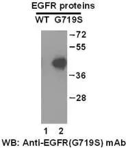Anti-EGFR (G719S) Mouse Monoclonal Antibody, 100 µl (26083), NEBA10148 Anti-EGFR (G719S) Mouse Monoclonal Antibody, 100 µl (26083), NEBA10148