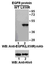 Anti-EGFR (L858R) Mouse Monoclonal Antibody, 100 µl (26082), NEBA10147 Anti-EGFR (L858R) Mouse Monoclonal Antibody, 100 µl (26082), NEBA10147