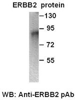 Anti-ErbB2 Rabbit Polyclonal Antibody, internal immunogen, 100 µl (21202), NEBA10075 Anti-ErbB2 Rabbit Polyclonal Antibody, internal immunogen, 100 µl (21202), NEBA10075