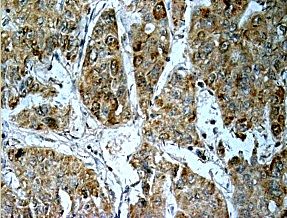 Anti-SLC7A5 Rabbit Polyclonal Antibody, 100 µl (21118), NEBA10060