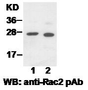 Anti-Rac2 Rabbit Polyclonal Antibody, 100 µl (21027), NEBA10018