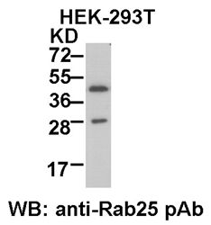 Anti-Rab25 Rabbit Polyclonal Antibody, 100 µl (21056), NEBA10037