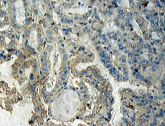 Anti-B-Raf Rabbit Polyclonal Antibody, 100 µl (21271), NEBA10087