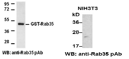 Anti-Rab3A Rabbit Polyclonal Antibody, 100 µl (21041), NEBA10028