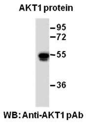 Anti-AKT1 Rabbit Polyclonal Antibody, 100 µl (21274), NEBA10089
