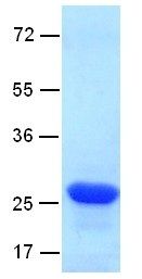 RalB Protein, 100 µg, (10169) NEBCC0073