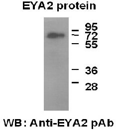 Anti-EYA2 Rabbit Polyclonal Antibody, 100 µl (21128), NEBA10063