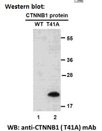 Anti-CTNNB1 (T41A) Mouse Monoclonal Antibody, 100 µl (26305), NEBA10206 Anti-CTNNB1 (T41A) Mouse Monoclonal Antibody, 100 µl (26305), NEBA10206